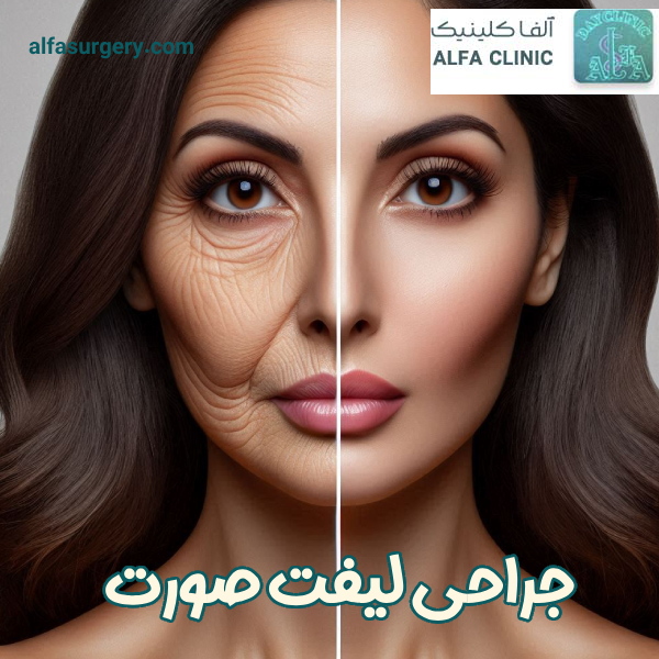 جراحی لیفت صورت | کلینیک آلفا
