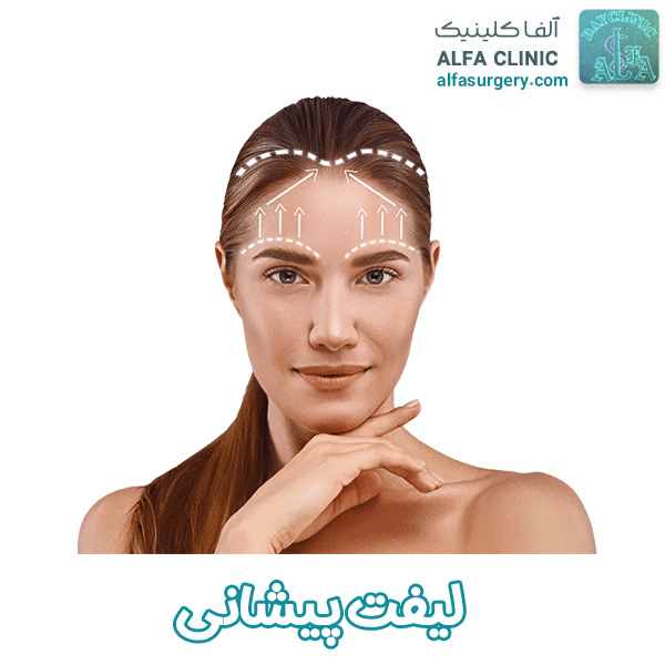 جراحی لیفت پیشانی  - مرکز جراحی الفا