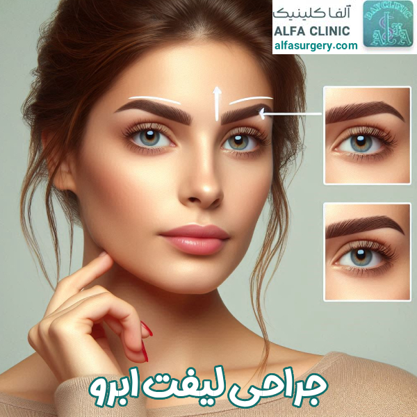 جراحی لیفت ابرو | مرکز جراحی آلفا