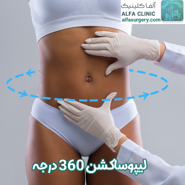 لیپوساکشن 360 درجه - مرکز جراحی آلفا