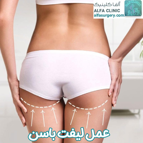 لیفت باسن | مرکز جراحی آلفا