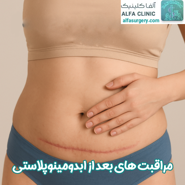 مراقبت های بعد از ابدومینوپلاستی - مرکز جراحی آلفا
