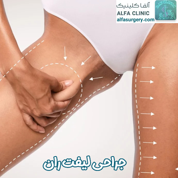 لیفت ران - مرکز جراحی آلفا