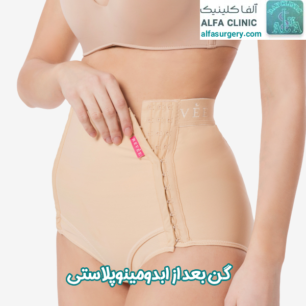 گن بعد از ابدومینوپلاستی - مرکز جراحی آلفا