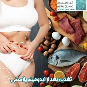تغذیه بعد از ابدومینوپلاستی - مرکز جراحی آلفا