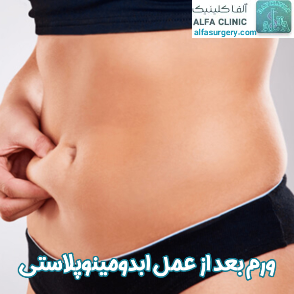 ورم بعد از ابدومینوپلاستی - مرکز جراحی آلفا