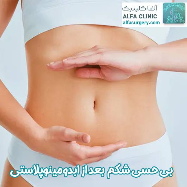 بی حسی شکم بعد از عمل ابدومینوپلاستی - مرکز جراحی آلفا
