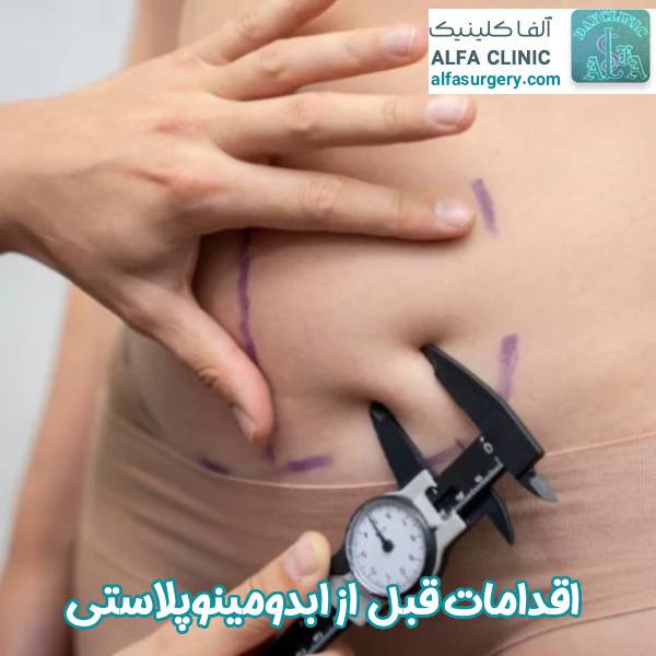 اقدامات قبل از ابدومینوپلاستی - مرکز جراحی آلفا
