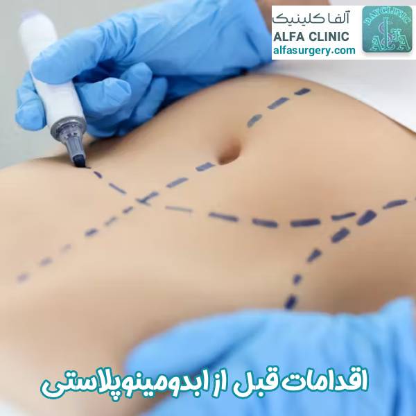 اقدامات قبل از ابدومینوپلاستی - مرکز جراحی آلفا