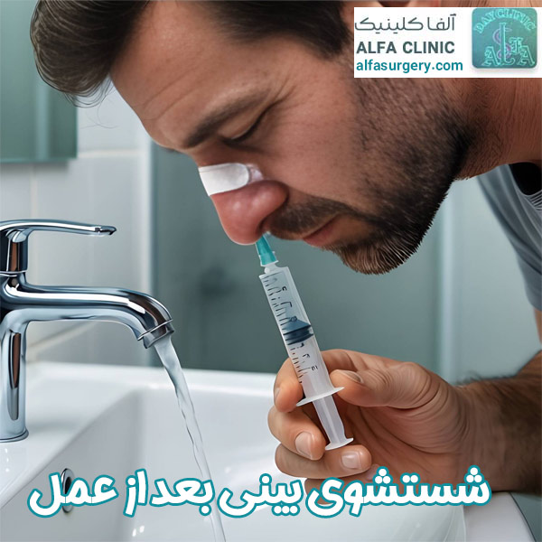 شستشوی بینی بعد از عمل - مرکز جراحی آلفا