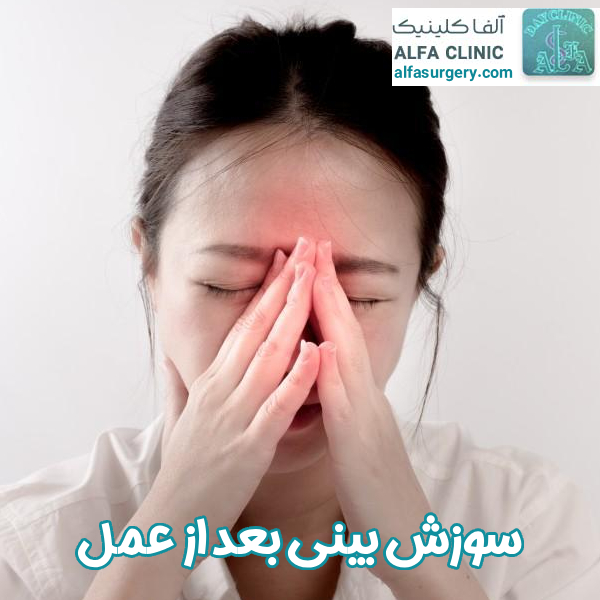 سوزش بینی بعد از عمل - مرکز جراحی آلفا