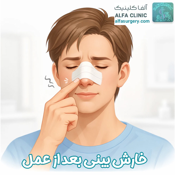 خارش بینی بعد از عمل