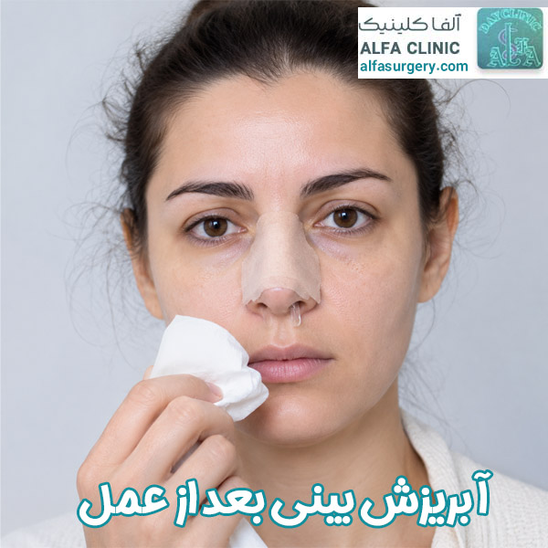 آبریزش بینی بعد از عمل - مرکز جراحی آلفا