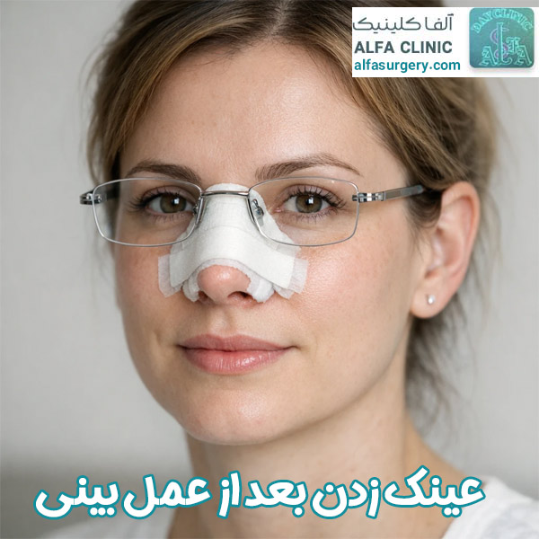 عینک زدن بعد از عمل بینی - مرکز جراحی آلفا